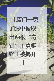 厦门一男子眼中被取出两根“毒针”！真相终于被揭开